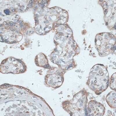 Immunohistochemistry-Paraffin: TMEPAI Antibody - Azide and BSA Free [NBP2-94649]
