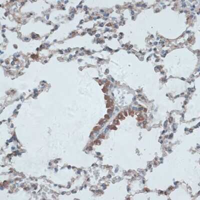 Immunohistochemistry-Paraffin: TMEPAI Antibody - Azide and BSA Free [NBP2-94649]