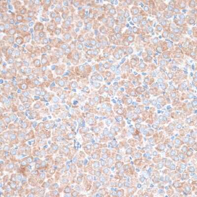 Immunohistochemistry-Paraffin: TMEPAI Antibody - Azide and BSA Free [NBP2-94649]