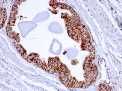 Immunohistochemistry-Paraffin: TMEPAI Antibody (PMEPA1/2696) - Azide and BSA Free [NBP2-79891]