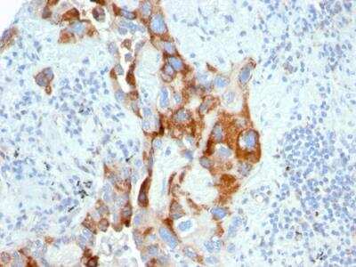 Immunohistochemistry-Paraffin: TMEPAI Antibody (PMEPA1/2696) - Azide and BSA Free [NBP2-79891]