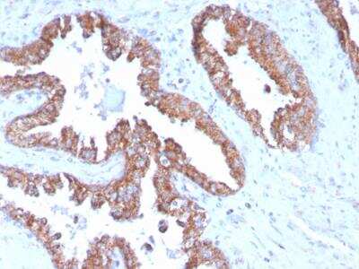 Immunohistochemistry-Paraffin: TMEPAI Antibody (PMEPA1/2696) - Azide and BSA Free [NBP2-79891]