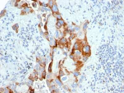 Immunohistochemistry-Paraffin: TMEPAI Antibody (PMEPA1/2696) [NBP2-79756]