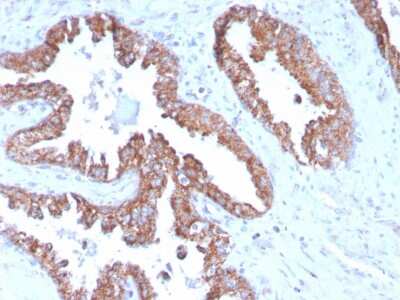 Immunohistochemistry-Paraffin: TMEPAI Antibody (PMEPA1/2696) [NBP2-79756]