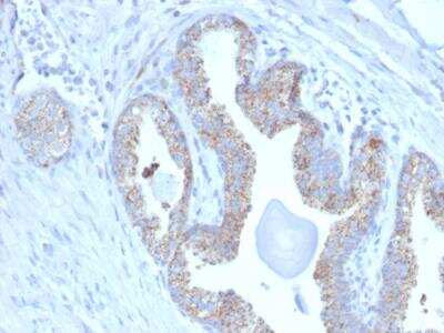 Immunohistochemistry-Paraffin: TMEPAI Antibody (PMEPA1/2697) - Azide and BSA Free [NBP2-79892]