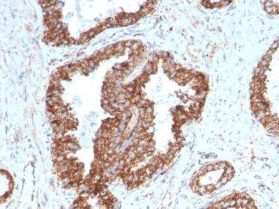 Immunohistochemistry-Paraffin: TMEPAI Antibody (PMEPA1/2698) - Azide and BSA Free [NBP2-79893]