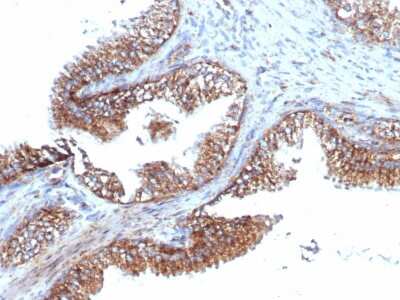 Immunohistochemistry-Paraffin: TMEPAI Antibody (PMEPA1/6421R) - Azide and BSA Free [NBP3-08260]