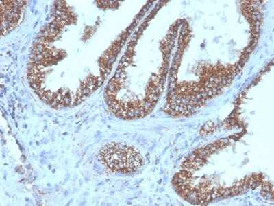 Immunohistochemistry-Paraffin: TMEPAI Antibody (PMEPA1/6421R) [NBP3-07246]