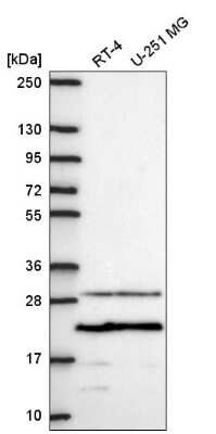 Western Blot: TMEPAI Antibody [NBP2-56657]