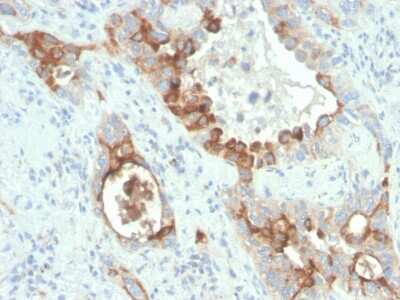 Immunohistochemistry-Paraffin: TMEPAI Antibody (rPMEPA1/6422) - Azide and BSA Free [NBP3-08259]