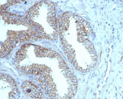 Immunohistochemistry-Paraffin: TMEPAI Antibody (rPMEPA1/6422) - Azide and BSA Free [NBP3-08259]