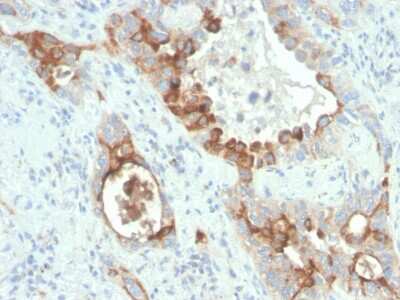 Immunohistochemistry-Paraffin: TMEPAI Antibody (rPMEPA1/6422) [NBP3-07245]