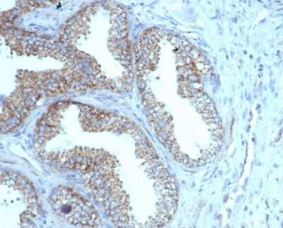 Immunohistochemistry-Paraffin: TMEPAI Antibody (rPMEPA1/6422) [NBP3-07245]