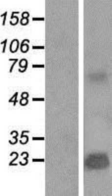 Western Blot: TMEPAI Overexpression Lysate [NBP2-04645]