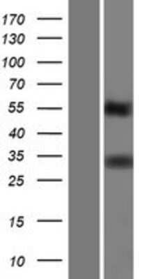 Western Blot: TMEPAI Overexpression Lysate [NBP2-06679]