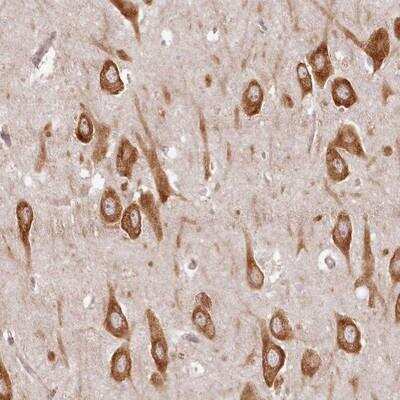 Immunohistochemistry-Paraffin: TMIE Antibody [NBP1-84260]