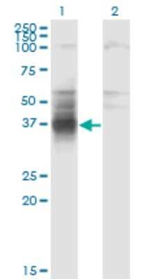 Western Blot: TMIGD1 Antibody (4A8) [H00388364-M01]