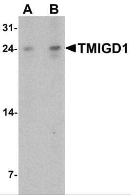 Western Blot: TMIGD1 AntibodyBSA Free [NBP2-81844]