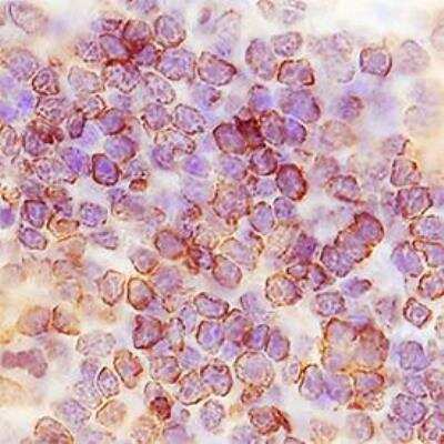 Immunohistochemistry-Paraffin: TMIGD2 Antibody (953730) - Azide and BSA Free [MAB83161]