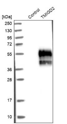 Western Blot: TMIGD2 Antibody [NBP1-81164]