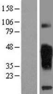 Western Blot: TMIGD2 Overexpression Lysate [NBL1-17114]