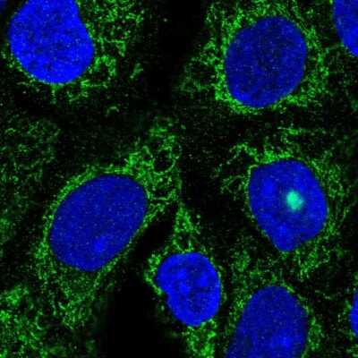 Immunocytochemistry/ Immunofluorescence: TMLHE Antibody [NBP2-55562]