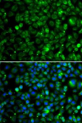 Immunocytochemistry/ Immunofluorescence: TMLHE Antibody - BSA Free [NBP3-04764]