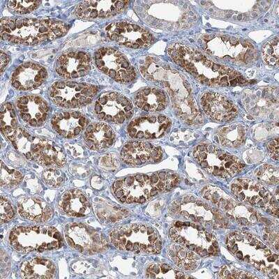 Immunohistochemistry: TMLHE Antibody [NBP1-88693]