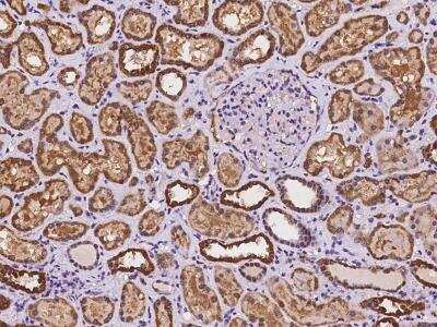 Immunohistochemistry-Paraffin: TMLHE Antibody [NBP3-06384]