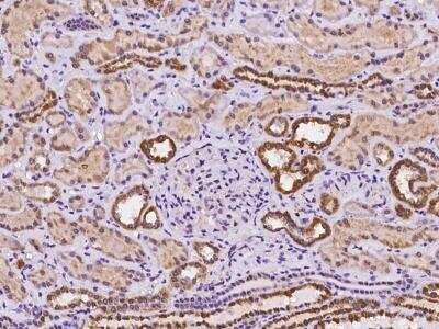 Immunohistochemistry-Paraffin: TMLHE Antibody [NBP3-06385]