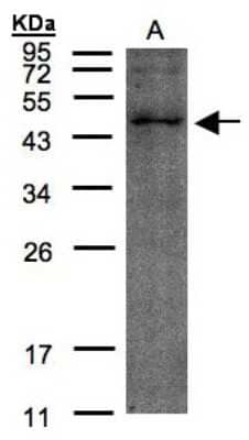 Western Blot: TMLHE Antibody [NBP1-32144]