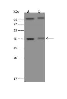 Western Blot: TMLHE Antibody [NBP3-06385]