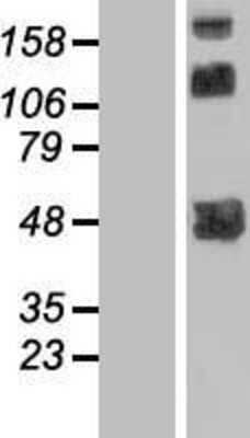 Western Blot: TMLHE Overexpression Lysate [NBP2-06856]