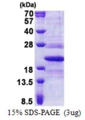 SDS-PAGE: Recombinant Human Tmp21/p23 His Protein [NBP2-22885]