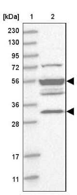 Western Blot: TMPPE Antibody [NBP1-93749]