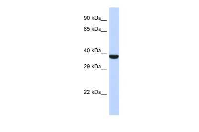 Western Blot: TMPPE Antibody [NBP2-83700]