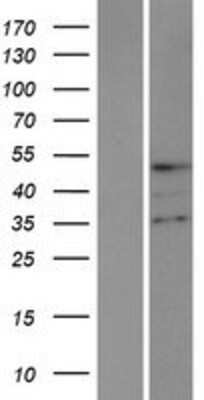 Western Blot: TMPPE Overexpression Lysate [NBP2-08531]