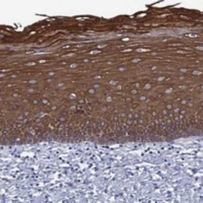 Immunohistochemistry-Paraffin: TMPRSS11A Antibody [NBP3-17322]