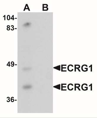 Western Blot: TMPRSS11A AntibodyBSA Free [NBP2-41140]