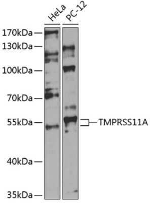 Western Blot: TMPRSS11A AntibodyBSA Free [NBP2-93093]