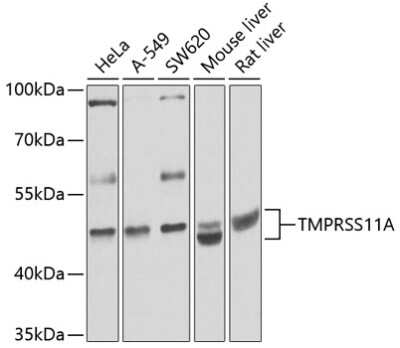 Western Blot: TMPRSS11A AntibodyBSA Free [NBP2-94784]