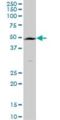 Western Blot: TMPRSS11B Antibody [H00132724-B01P]