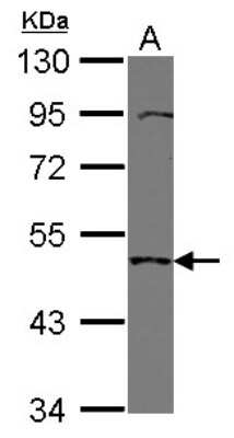 Western Blot: TMPRSS11B Antibody [NBP2-20667]