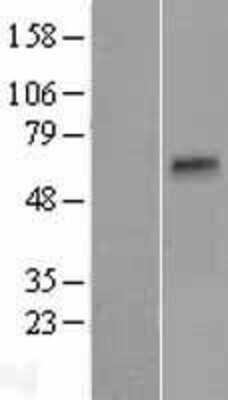 Western Blot: TMPRSS11B Overexpression Lysate [NBP2-04859]