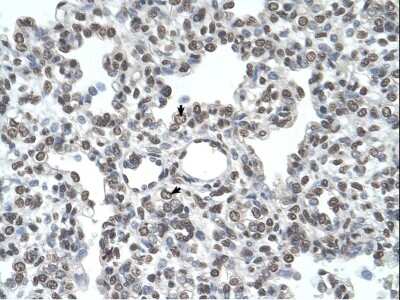 Immunohistochemistry-Paraffin: Airway Trypsin-like Protease/HAT/TMPRSS11D Antibody [NBP1-62546]