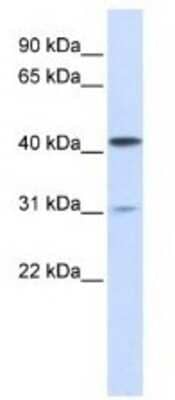 Western Blot: Airway Trypsin-like Protease/HAT/TMPRSS11D Antibody [NBP1-62546]