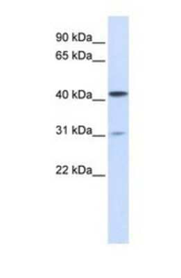 Western Blot: Airway Trypsin-like Protease/HAT/TMPRSS11D Antibody [NBP1-69558]