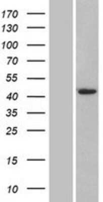 Western Blot: Airway Trypsin-like Protease/HAT/TMPRSS11D Overexpression Lysate [NBP2-07891]