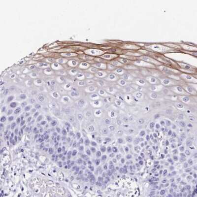 Immunohistochemistry: TMPRSS11E Antibody [NBP2-48995]