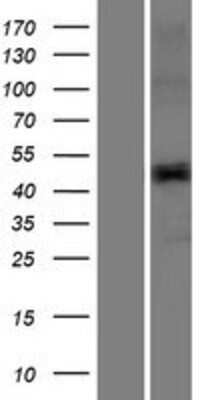 Western Blot: TMPRSS11E Overexpression Lysate [NBP2-07384]